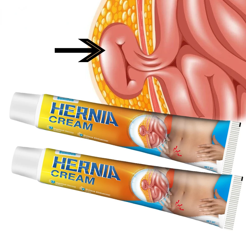 Crema de tratamiento de Hernia, ungüento Inguinal Umbilical femenino, antihinchazón, alivio del dolor, yeso médico, 20g