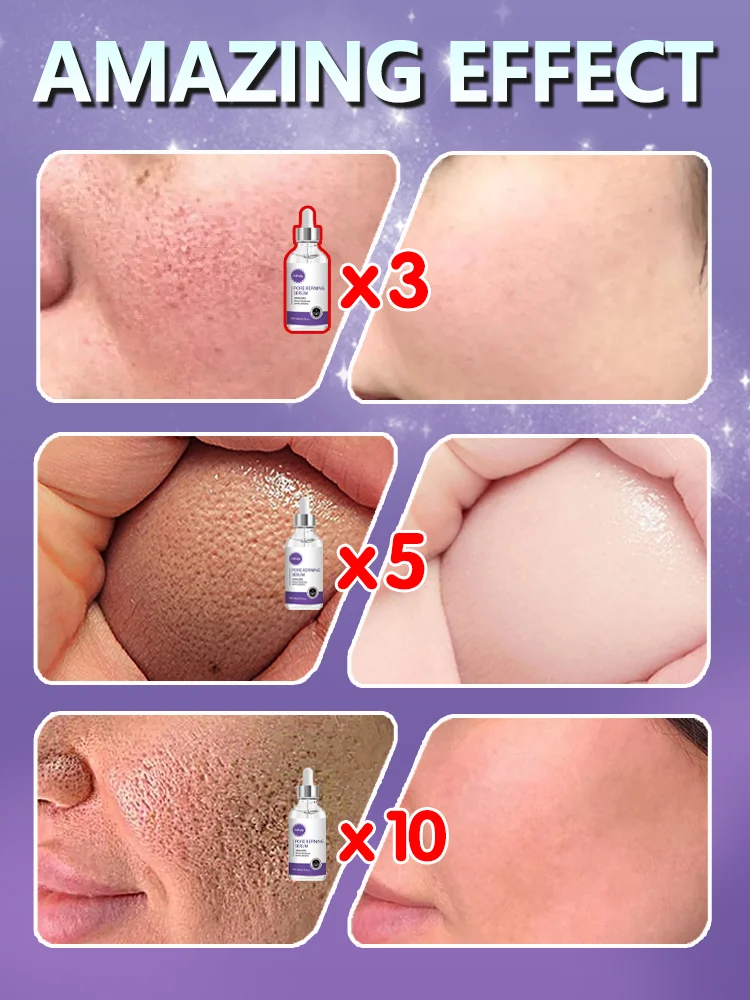 Removing Large Pores Pore Shrinking Serum Face Tightening Repairing Facial Pore Minimizing Moisturizing Skin Care Product