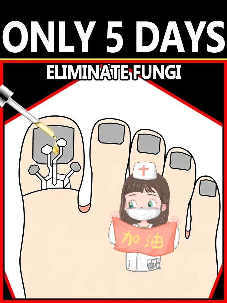 

25Worth investing in¹⁰⁰%ᵀʳᵉᵃᵗᵐᵉⁿᵗ ᵒᶠ ⁿᵃⁱˡ ᶠᵘⁿᵍᵘˢ5 day