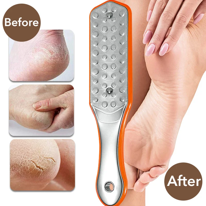 1Pcs Foot File Foot Scrubber Pedicure Callus Remover Professional Foot Scraper Cracked Dead Skin Remover for Dry and Wet Feet