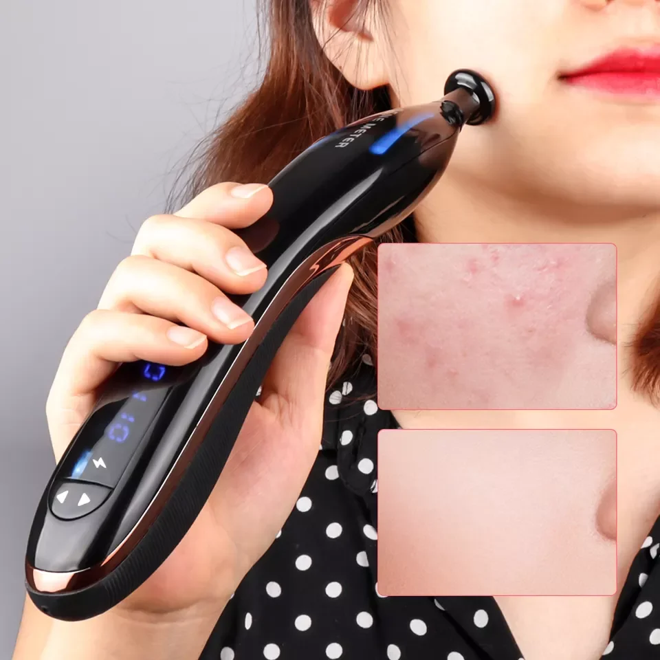 

Wireless plasma elevator Acne treatment machine Beauty machine