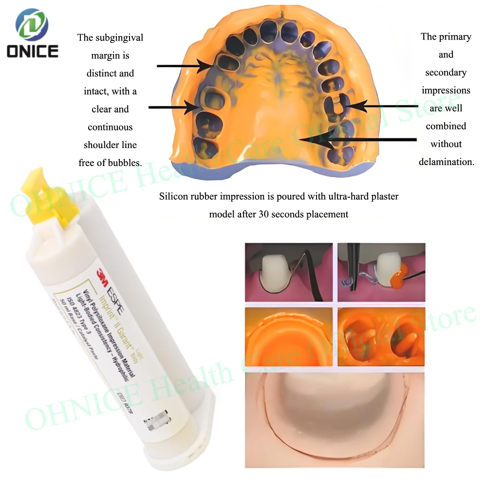 

Желтая стоматологическая силиконовая слепочная мамага низкой вязкости — заправка для корпуса Garant Light 3M ESPE Imprint II (продукт) # 9378)