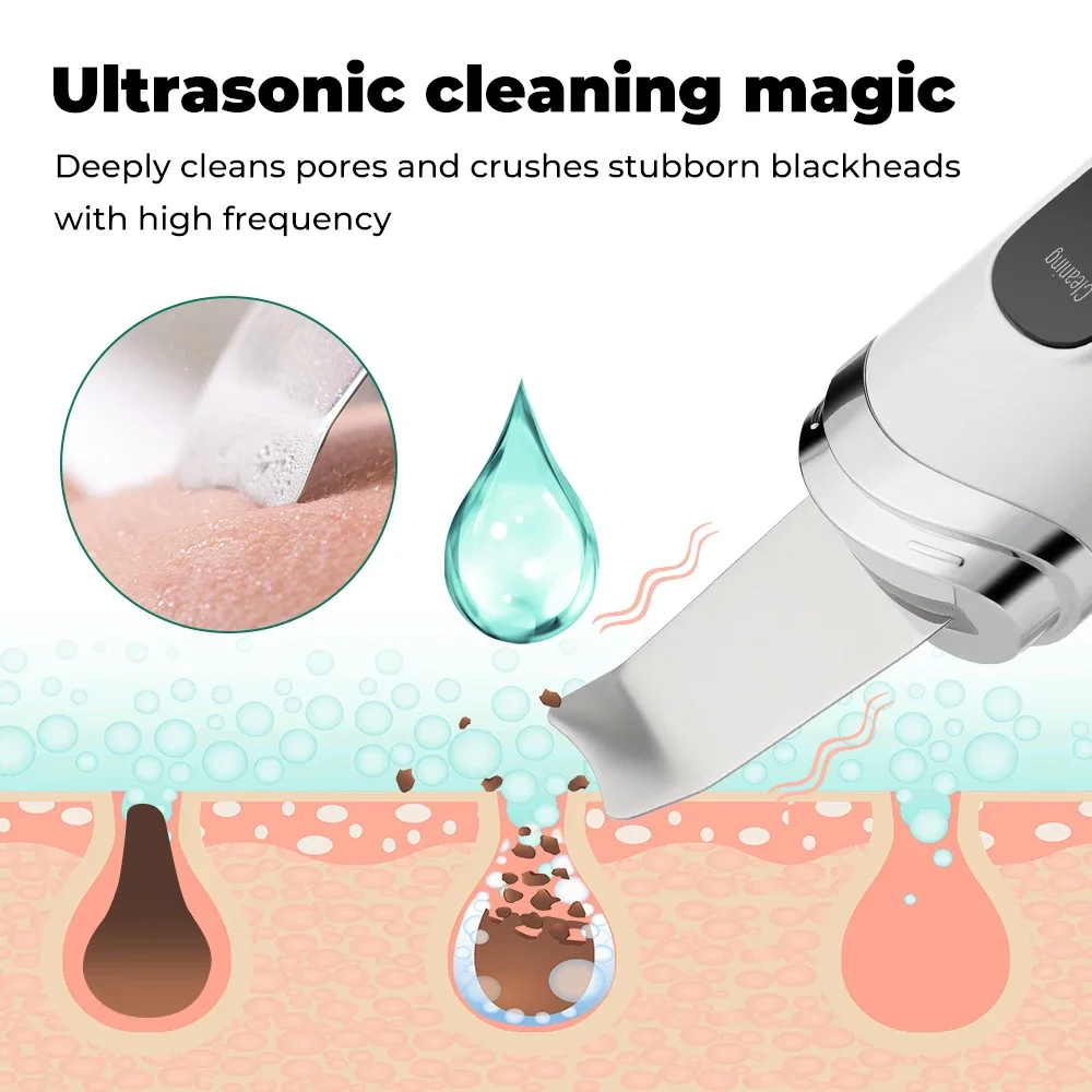 Ultrasonic Skin Scrubber Deep Vibrating Cleansing Spatula Ultrasonic Ionic Pore Cleanser Blackhead Remover Shovel Skin Care Tool