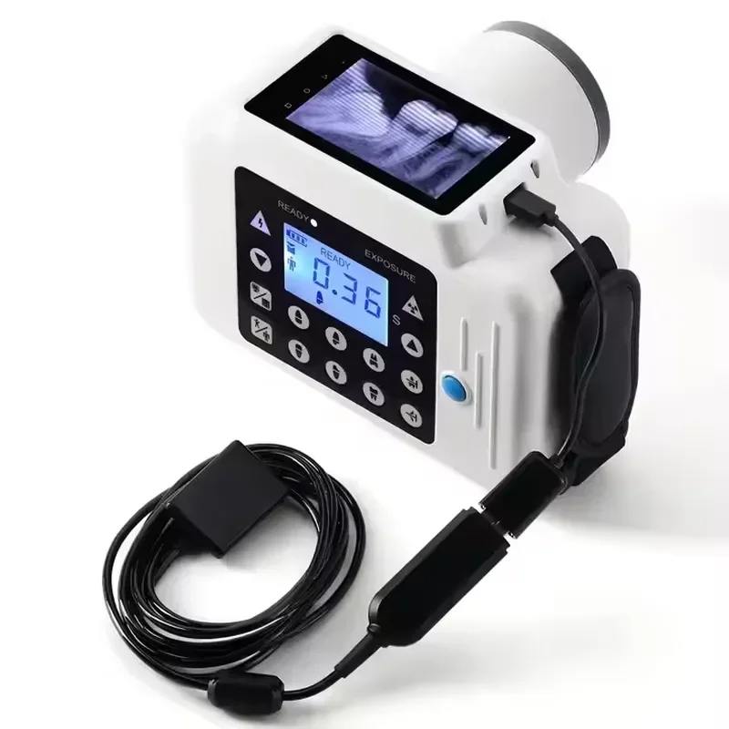 New Portable Dental X Ray Machine with Touchscreen for Clear Instant Images in Dentistry