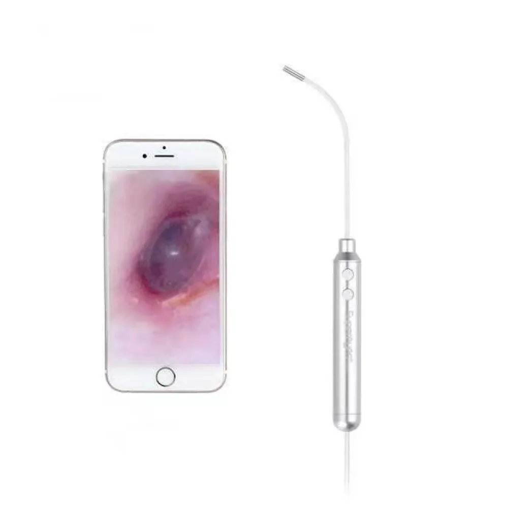 Medical 4mm Flexible Shaped Digital Otolaryngoscope Ear Nose Throat High Quality Dental Examination Otoscope Endoscope
