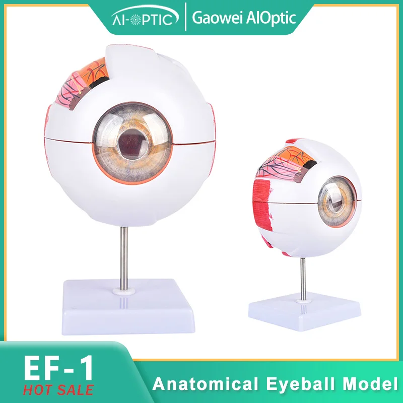 6X Enlarged Human Eye Anatomy Model, Eyeball Diseases Study, Teaching Demonstration Prop, Ophthalmology Learning Tool Optic 