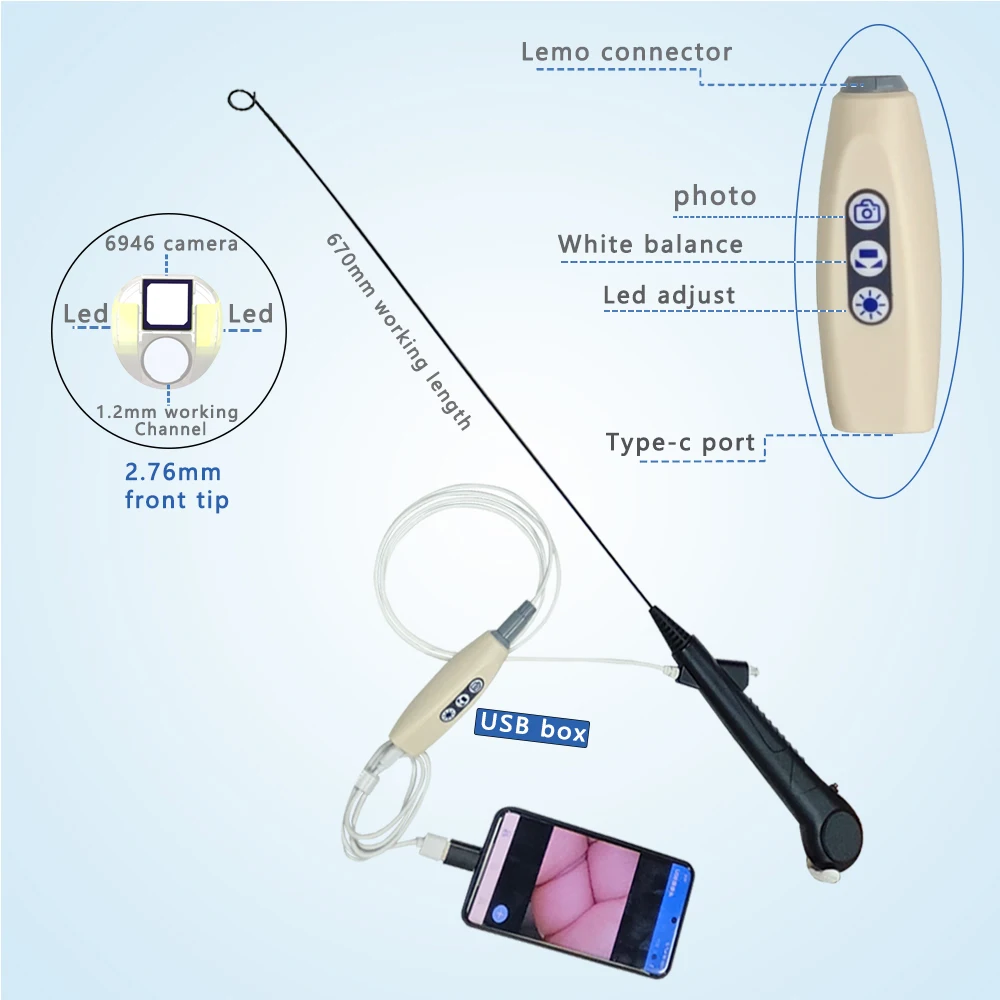 New Durable Disposable Ureteroscope Flexible Bronchoscope Veterinary Endoscope Wholesale Medical 720P Resolution 670mm Working