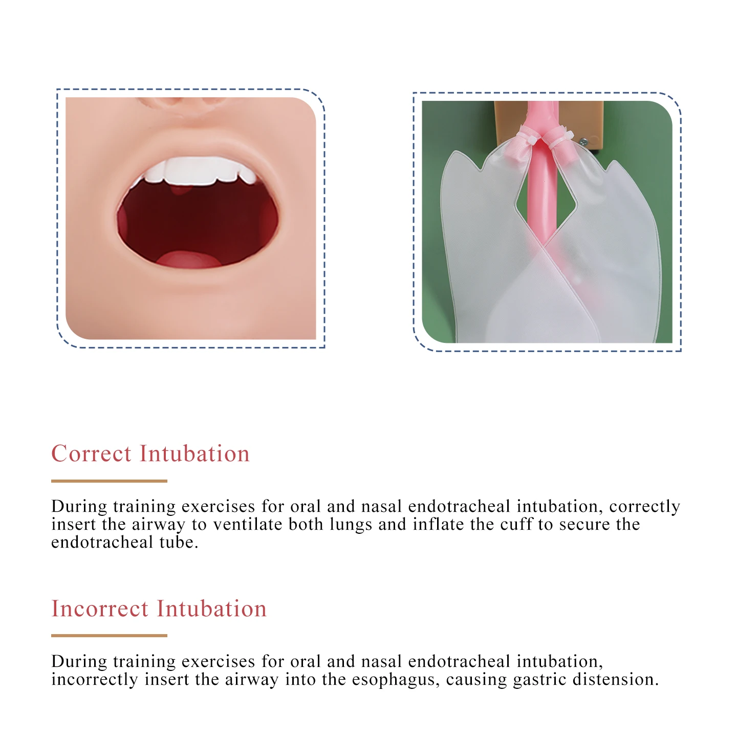 DARHMMY Advanced Paediatric Tracheal Intubation Manikin; Paediatric Oropharyngeal Tracheal Anatomy; Oral and Nasal Tracheal Intu