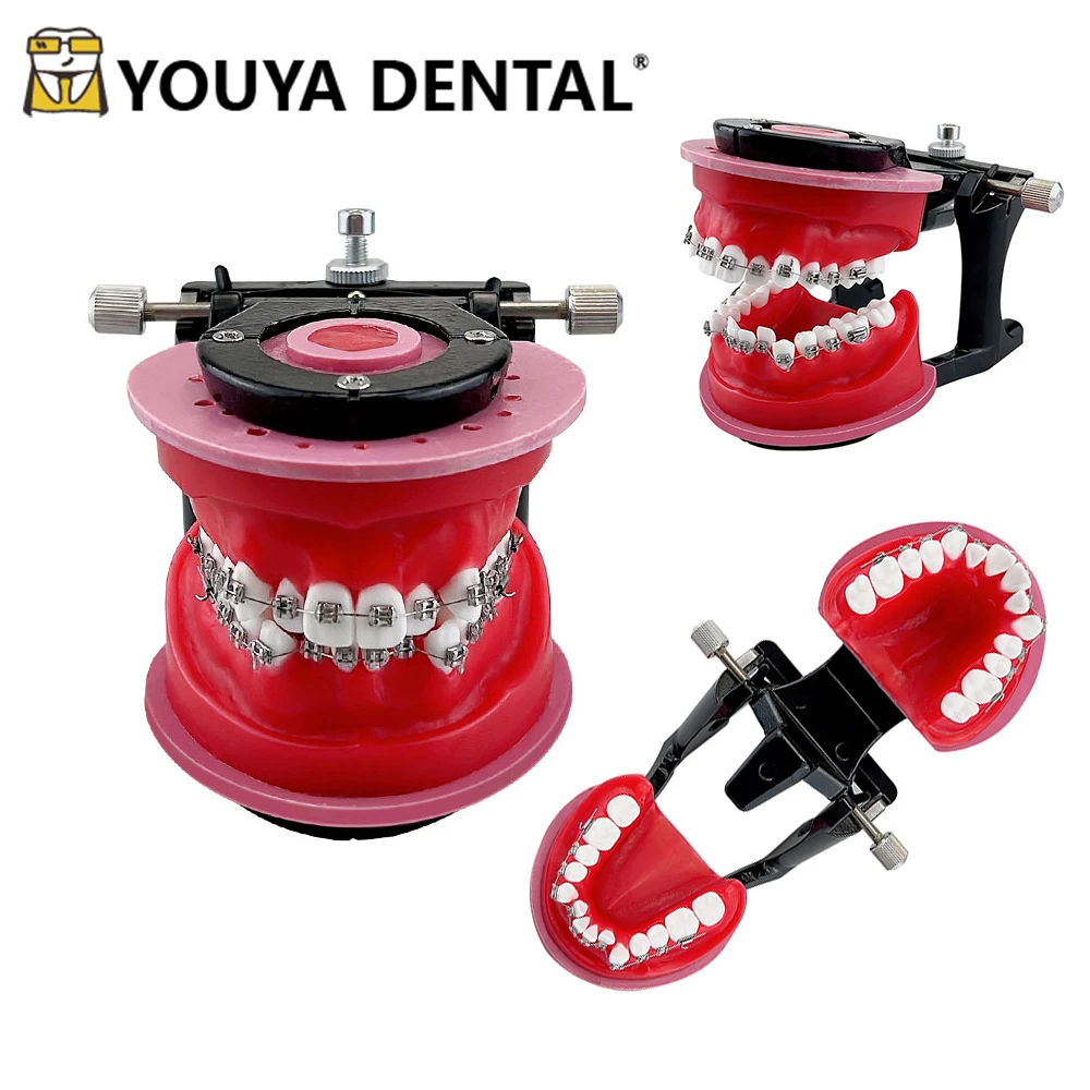 Orthodontic Models with Metal Bracket Red Wax Gum Tooth Teaching Model For Dental Technician Practice Training Studying Model