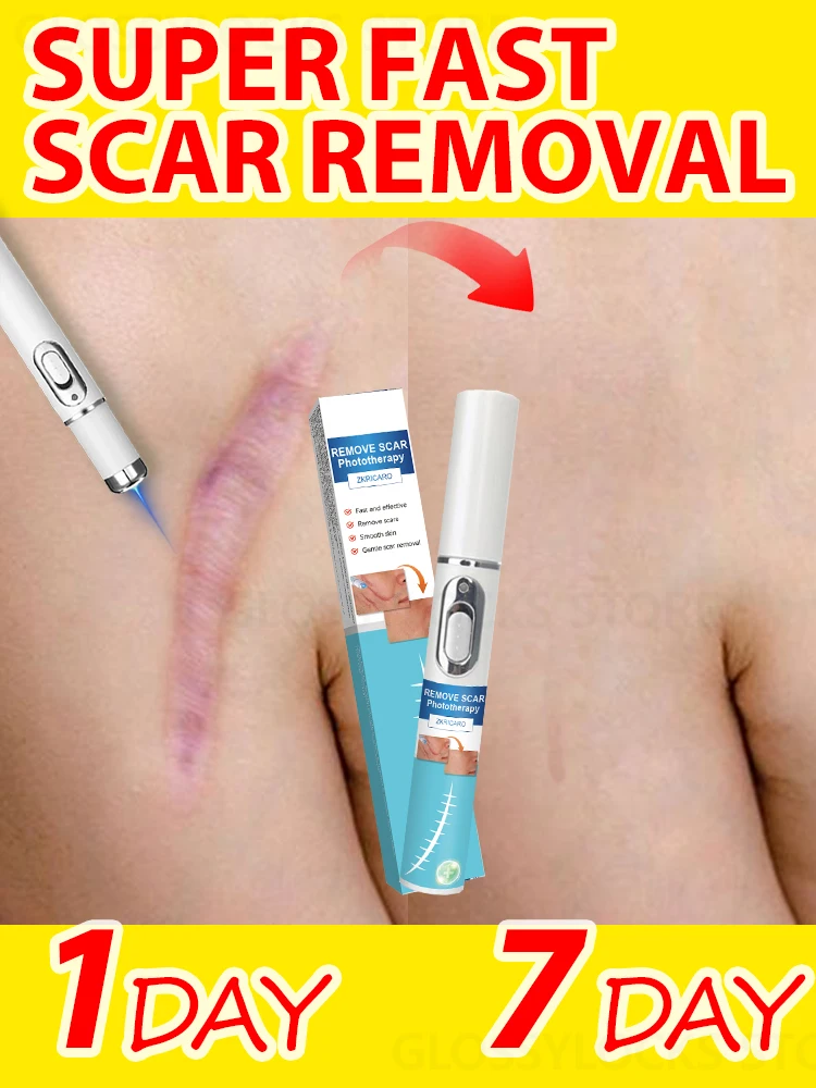 LASER PEN for scar ，For all kinds of scars，Burn，Surgical scar，Various scars age