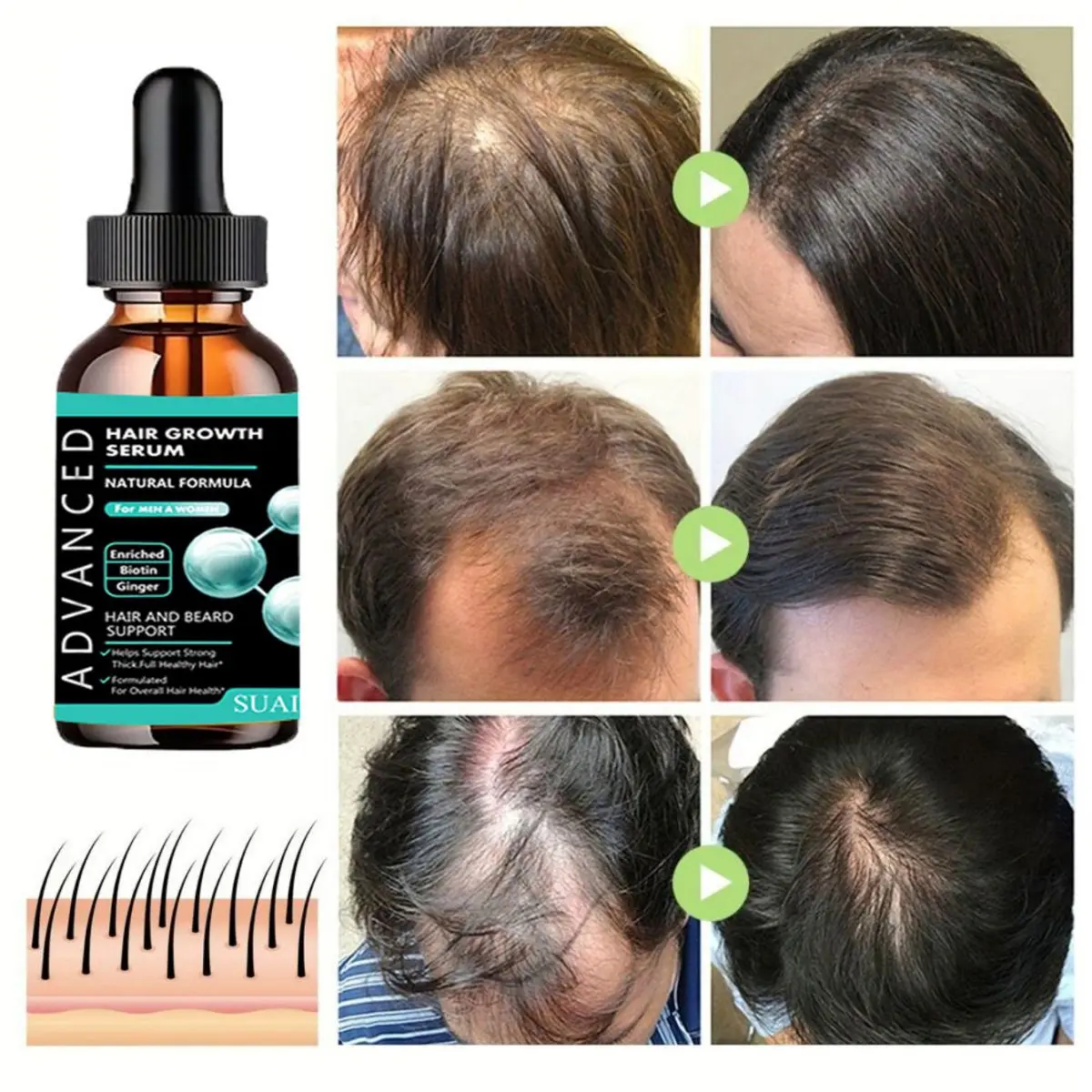 Crescimento do cabelo para homens ferramenta de crescimento de óleo essencial reparação do cabelo proteção furcation cuidados com o crescimento do