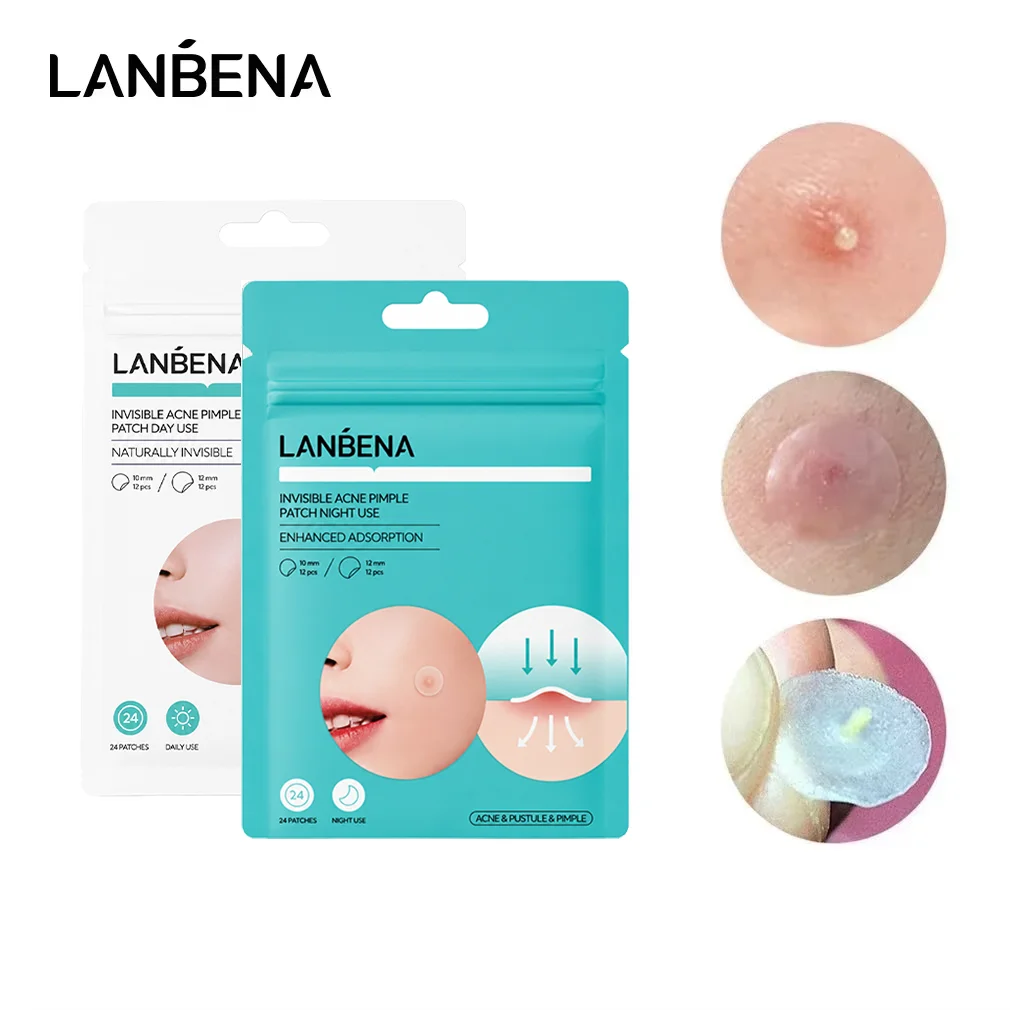 LANBENA Repair Acne Patch Facial Skin Care Fade Blemishes Pimple Marks Closed Acne Blemishes Cover Acne Pimple Repair Patch