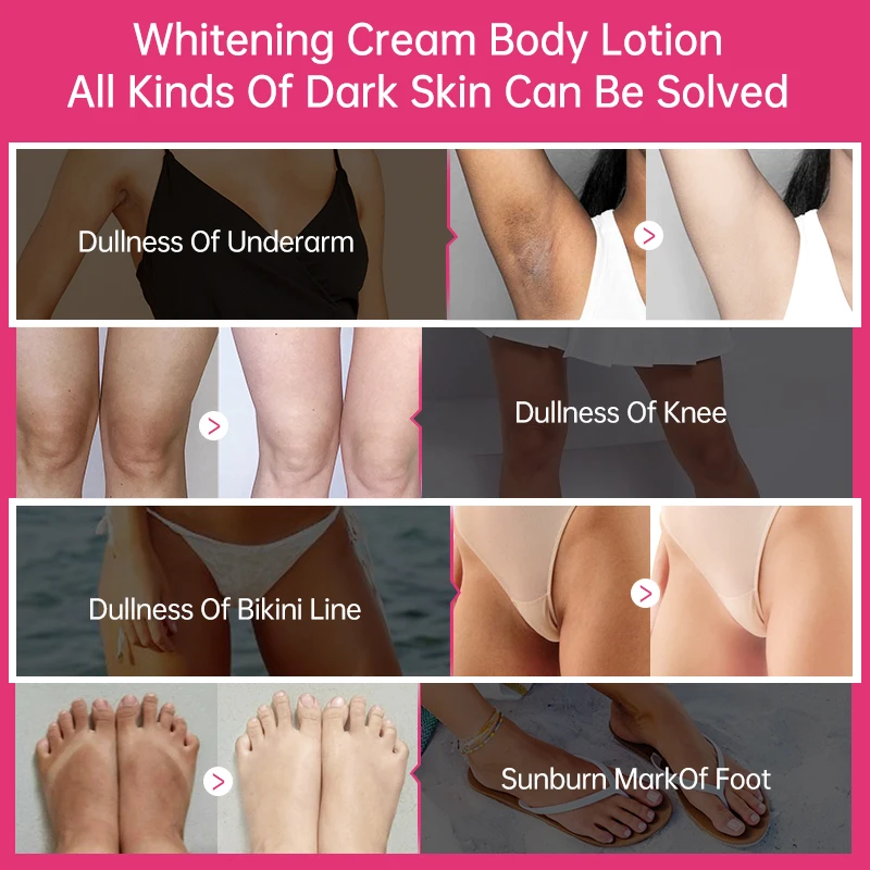 Collagen Whitening Cream Intimate Area Dark Skin Removeal Sensitive Areas Underarm Inner Thigh Lightening Body Cream Skin Care