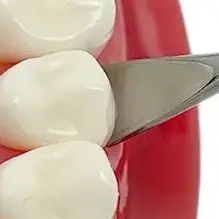 

1Pcs Dental Implant Gingival Retractor Stainless Steel Dental Gum Separator Isolation Surgical Tool