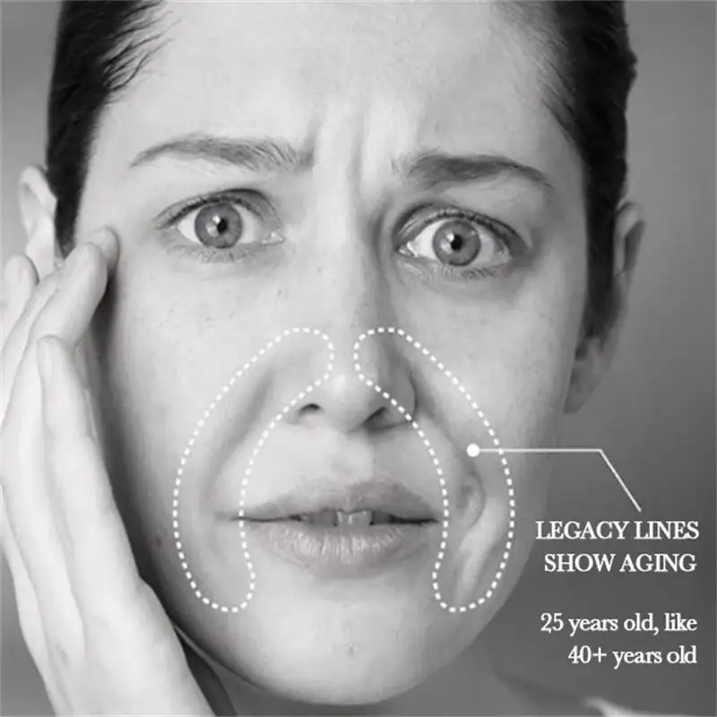 Patch Lipatan Nasolabial Mengandung Kolagen Asam Hialuronat Pengencang Kulit Memudarkan Garis Halus Masker Wajah Pelembab Dalam Anti Kerut