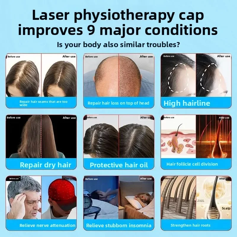 Portable rechargeable LLLT hair growth instrument, anti-hair loss, hair care and physiotherapy cap