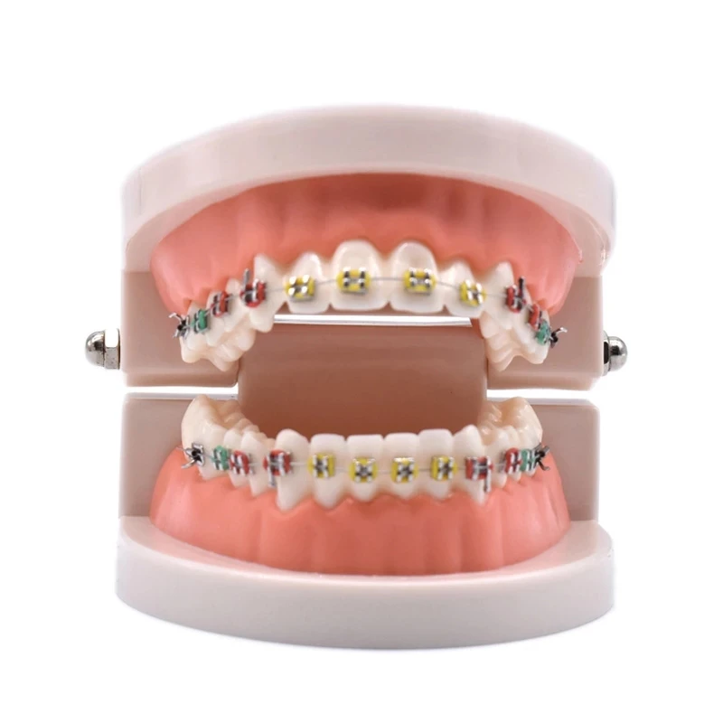 Dental Teeth Model Teach Study Standard Typodont Demonstration Teeth Model With Bracket