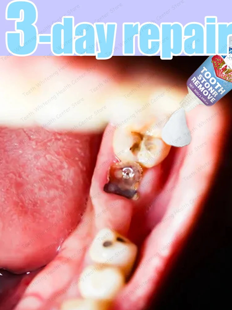 #34 New Dentures Arrivals