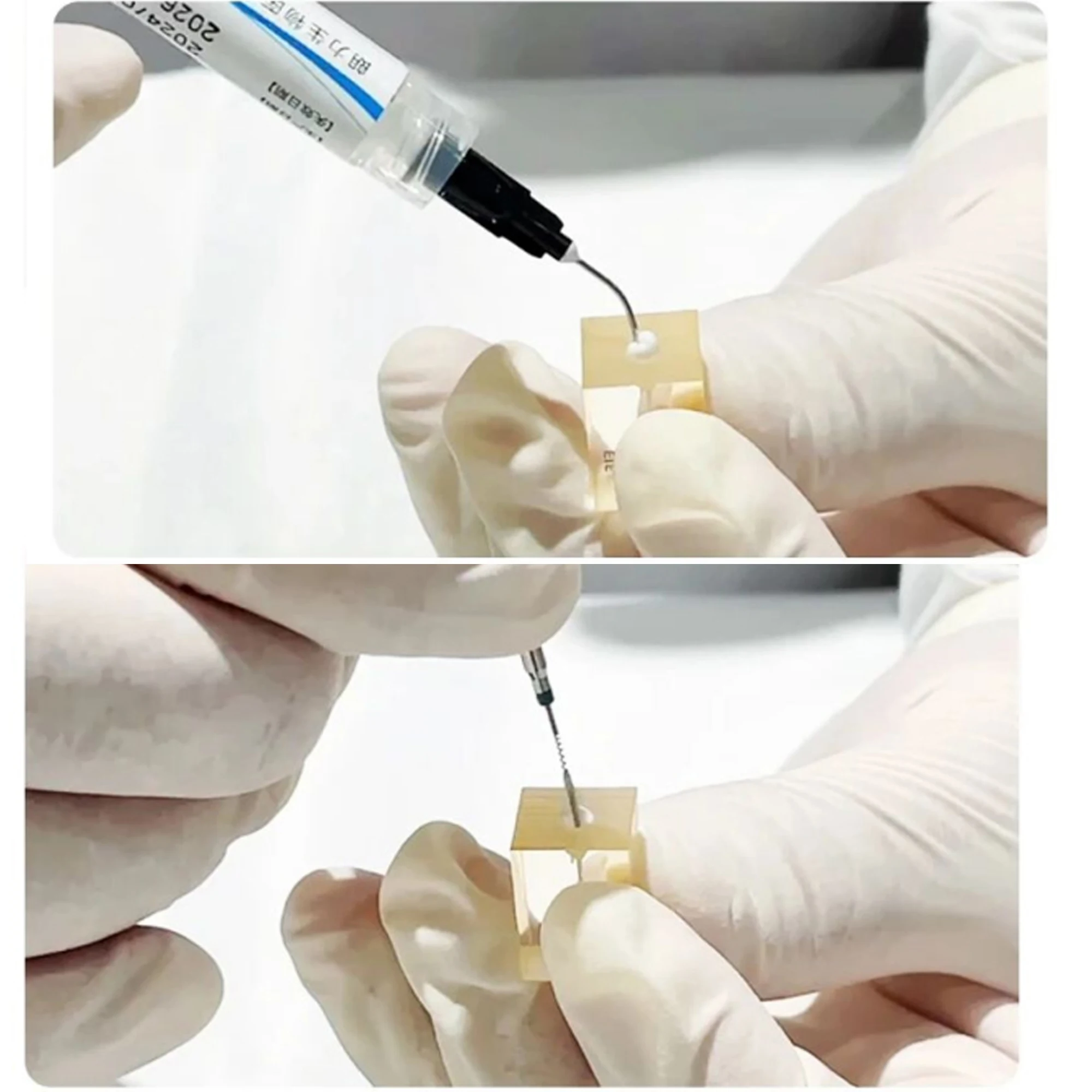 LONGLY Calcium Hydroxide Root Canal Disinfection Paste 2g, Push Assist Type II Dental Root Canal Disinfection Material