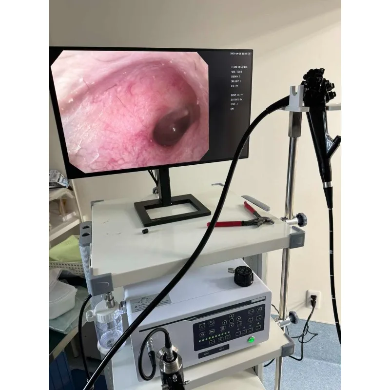 Veterinary Flexible Endoscope System Excellent Medical Camera for Endoscopic Procedures Commercial Equipment and Animal Care