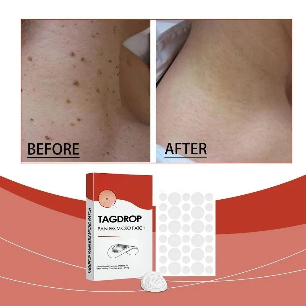 

144PCs Face Patches For Pimples Microneedles Drying Patch Blemish Covering Stickers Invisible Spot Care Beauty Face Care Tool