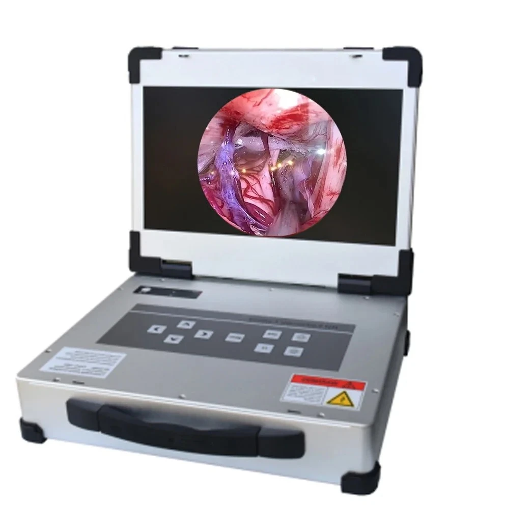 video ent endoscopy / All in one Por ENT / endoscopy system