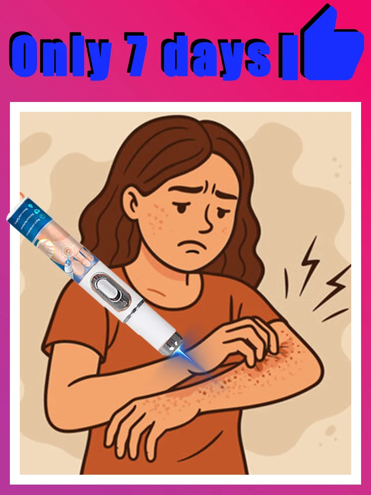 

2025 New Worry-free wart removal,blue light pen solve warts,free shipping,hotsale wart care tools