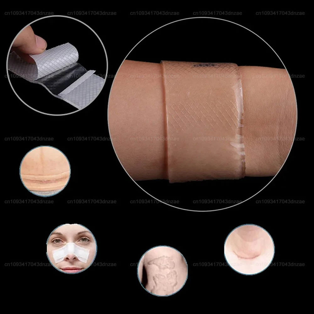 

1-30pcs 3*12cm Removal Silicone Gel Away Silicone Scar Sheets Silicon Gel Patch Scars Caused By Injuries Burns Efficient Beauty