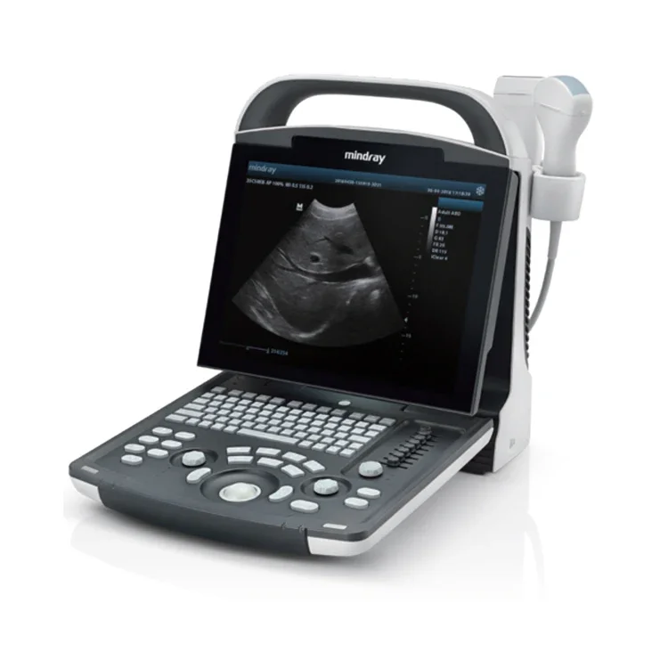 Original Mindray Digital Ultrasonic Diagnostic Imaging System DP-10 Portable B/W Ultrasound Scanner Machine