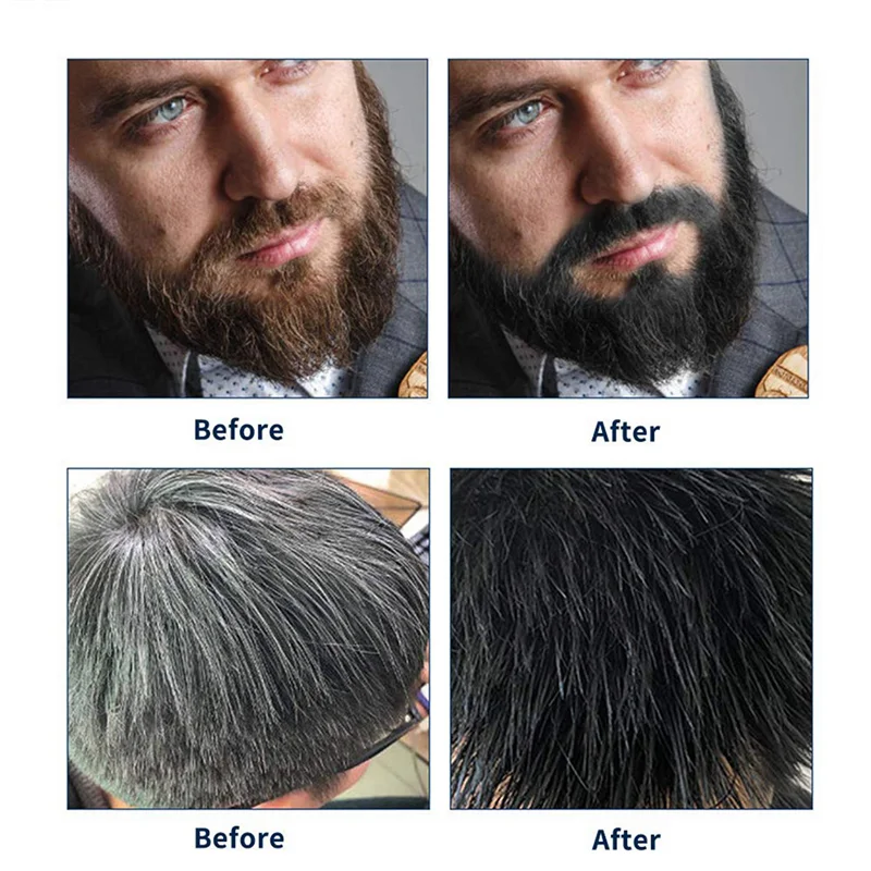 

Hot Sale 3X Permanent Beard Dye Shampoo For Men Beard Dying Removal White Grey Beard Hair Men Beard Shampoo 200ML