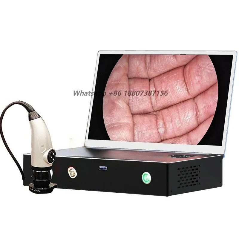 Laptop-mounted veterinary endoscopic  system for human and animal surgery with full high definition  CMOS sensor
