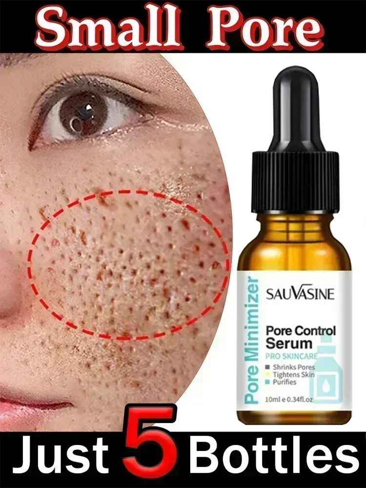 

Acid Pore Shrinking Serum Face Removing Large Pores Tightening Repairing Facial Pore Minimizing Essence Oil Firm Skin Care4910