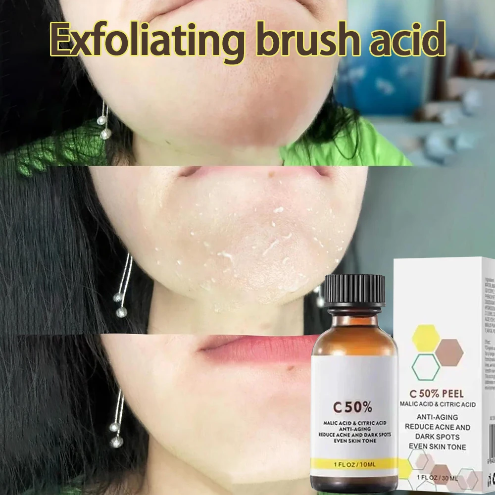 

Acid Peeling Gel Facial Cleansing Exfoliating Peeling Scrub Cream Deep Clean Moisturizing Blackhead Remove Dead Lighten Melanin