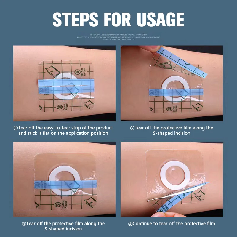 10pcs Waterproof Anti-allergic Medicinal Wound Dressing Fixation Tape Navel Medical Transparent Tape PU Film Adhesive Plaster image 2