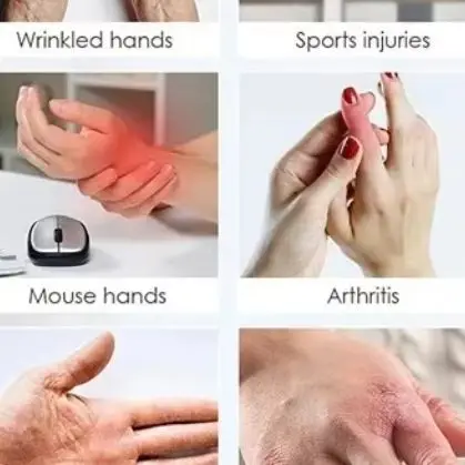 

Профессиональные перчатки для фотобиомодуляции, жесткость суставов пальцев, боль в руках и ладони