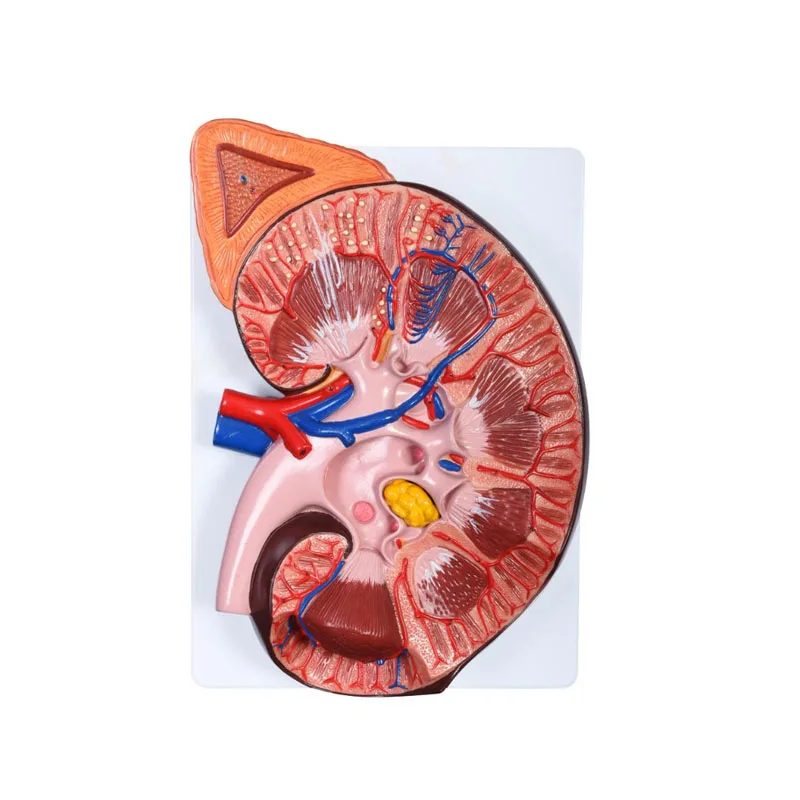 

High Quality Anatomical Enlarged Human Kidney Educational Model