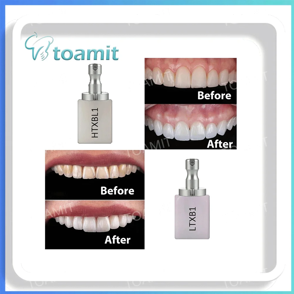 

3Boxes Dental Ceramic Blocks, High Translucent HT/LT Zirconia Disc for CAD/CAM, Anterior Crowns Veneers, Sirona CEREC Compatible