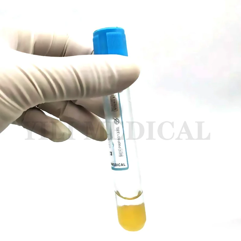 Disposable sodium citrate separation gel blood collection device sterile laboratory PRP tube blood collection tube 8ml