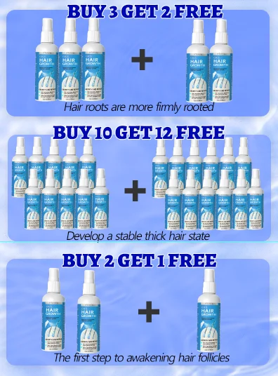 

ᴳᵒᵒᵈᵇʸᵉ! ᵒⁱˡʸ! No dandruff. Say goodbye to hair parting anxiety