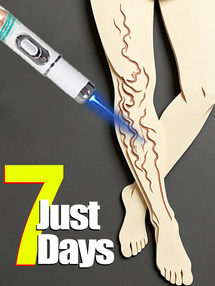 

100% effective, helping people with leg discomfort alleviate their worries.