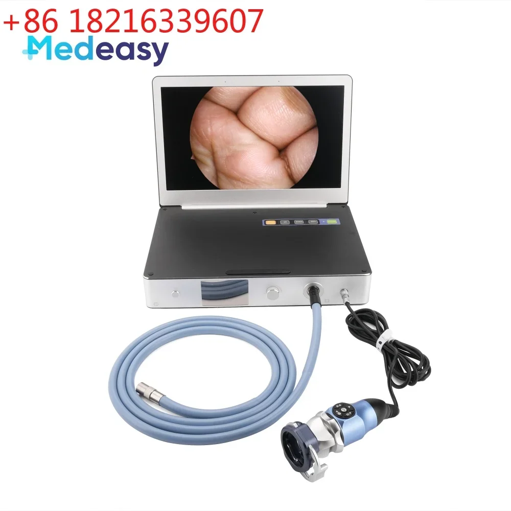 YAO Medical Full HD Endoscope Camera with 30W LED Cold Light Source and 11.6 Inch Monitor
