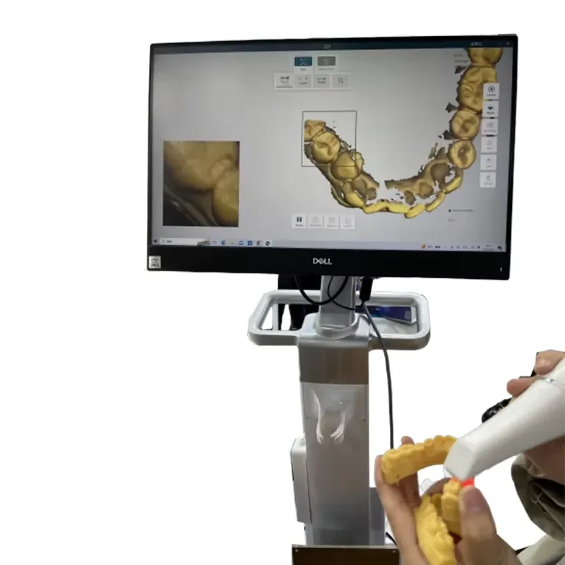 2026 New, High Quality, New Arrival Cart Dental Intraoral 3D Scanner for Professional Oral Imaging and Digital