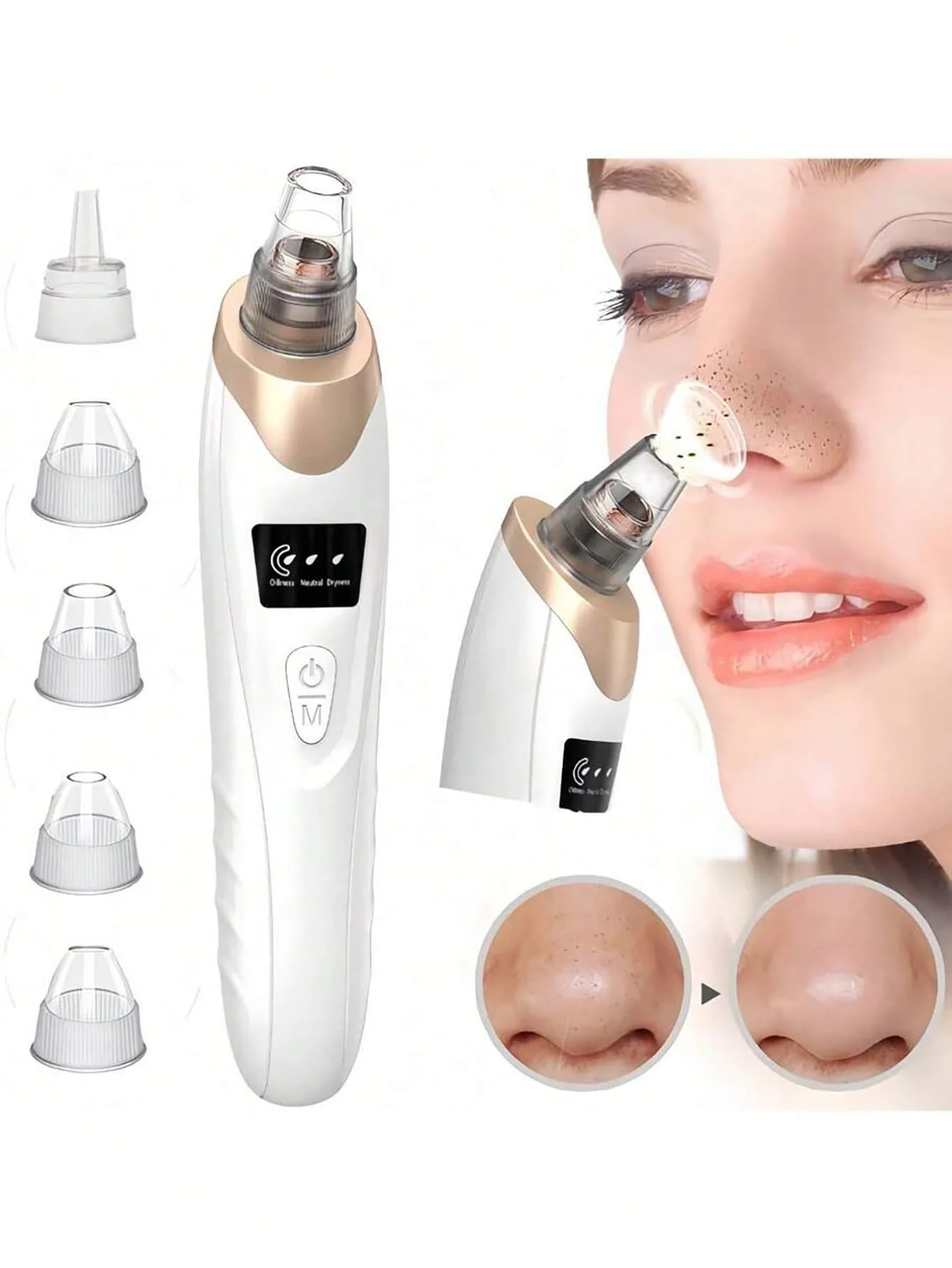 1 Blackhead Remover Pore Vacuum Cleaner, Facial Pore Cleaner, 5 Suction Heads, 3 Suction Forces, Vacuum Cleaner USB Rechargeable