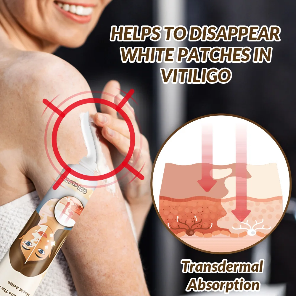 

Vitiligo лечение, пигментация, улучшение пигментации кожи, эффективное и безопасное для всех типов кожи