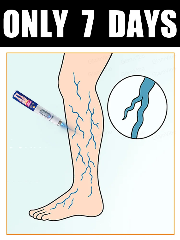 

No more tight veins in 7 days