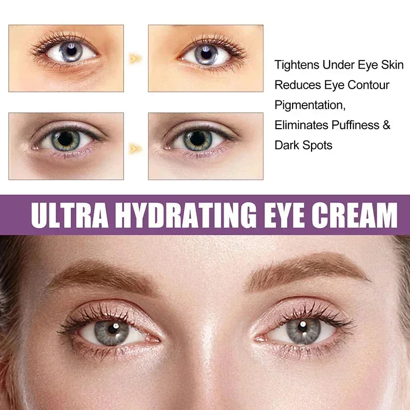 Instant Eye Bag Removal Cream Retinol Anti-Wrinkle Firming Skin Fade Fine Lines Anti Dark Circle Puffiness Brighten Eye Care