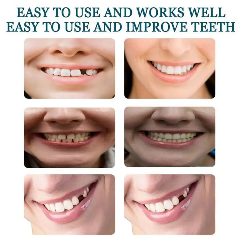 偽の歯のベニア 取り外し可能で再利用可能なベニア歯 快適なフィット感の歯 一時的な歯の入れ歯 偽の歯用