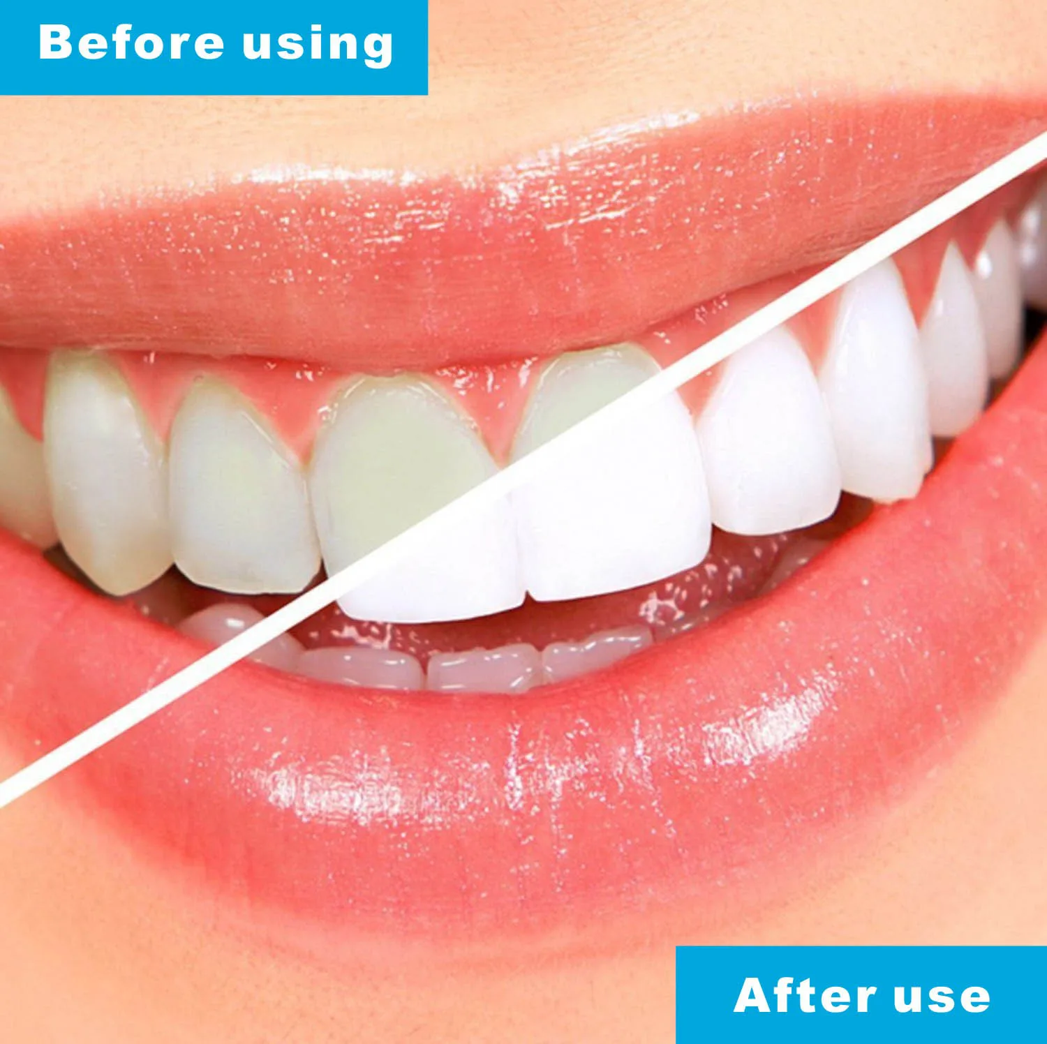 4PCS Anti Snoring Mouth Guard Night Guard Gum Shield Mouth Tray Grinding Bruxism Snore Stopper Sleep Anti Snore Sleeping Aid image 6