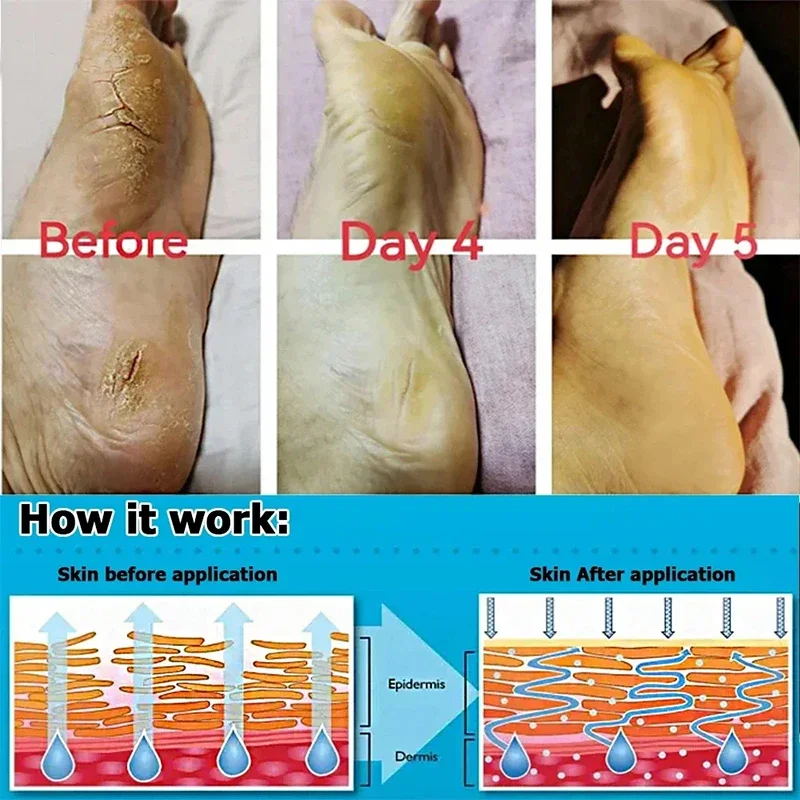 Ungüento para el cuidado de la piel, en el talón antigrietas crema a base de hierbas, producto de reparación, exfoliación, eliminación de piel muerta, hidratante y suavizante