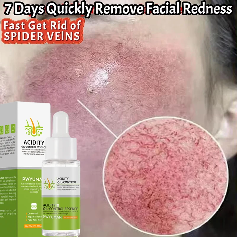 Repair Facial Redness Serum Instant Spider Vein Remove Sensitive Skin Sooth Anti Redness Rosacea Treat Lotion Korean Cosmetics